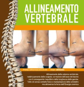 Allineamento vertebrale
